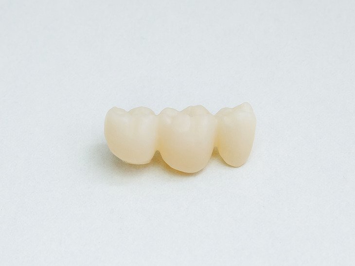 Костная пластика при имплантации зубов: виды, особенности, показания